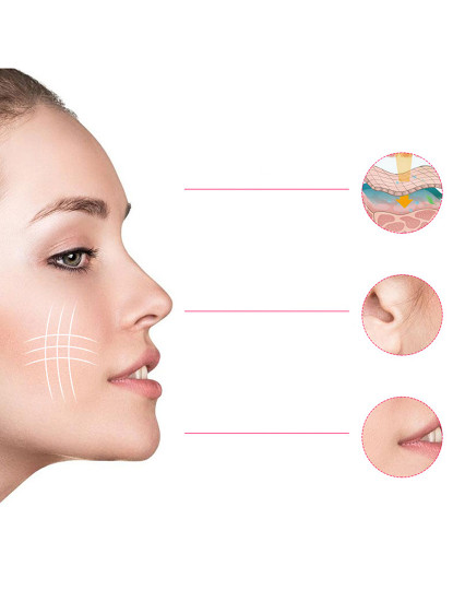 imagem de Dispositivo EMS de eletroestimulação facial2